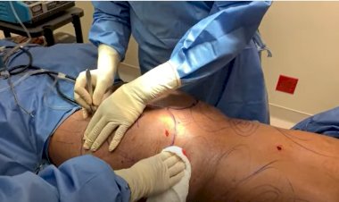 New audit reveals 44% rise in botched cosmetic surgery abroad