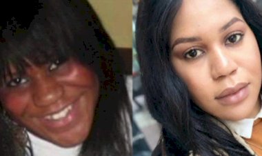 Rise in deadly skin whitening products